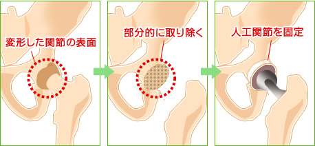 koshi_koutei1.jpg